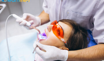 Professional Teeth Whitening 101